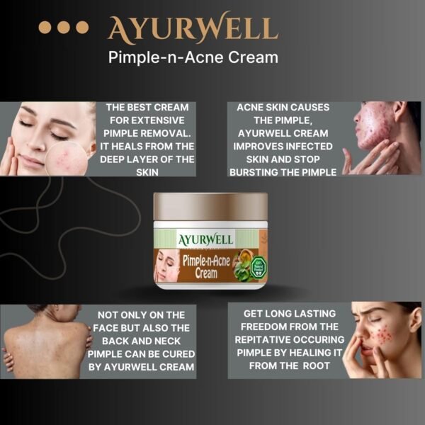 AyurWell Anti Acne Cream, Anti Pimple Treatment - Image 3