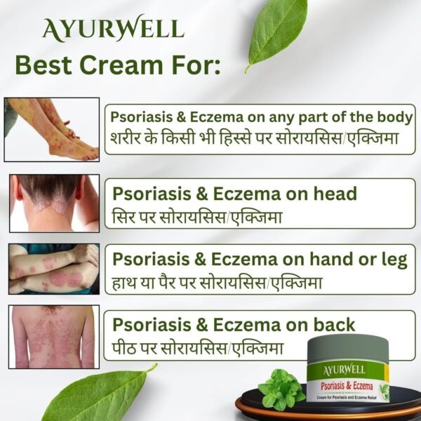 AyurWell Psoriasis Cream | Natural Formula for Psoriatic, Dry Itchy Skin | Itching, Flakes, Redness | Helps Retain Moisture | Psoriasis Body Cream - Image 2