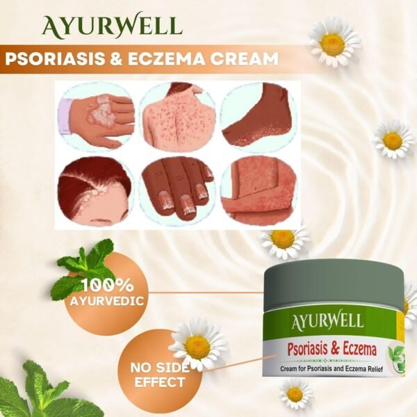 AyurWell Psoriasis Cream | Natural Formula for Psoriatic, Dry Itchy Skin | Itching, Flakes, Redness | Helps Retain Moisture | Psoriasis Body Cream - Image 3
