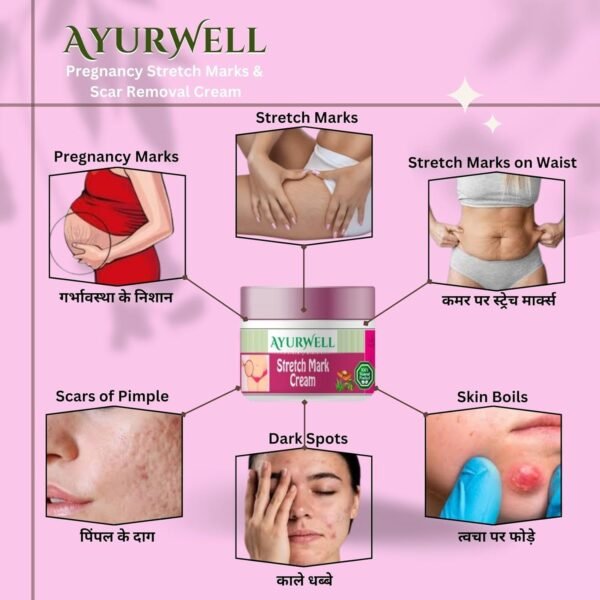 AyurWell Cream for Stretch Marks | Scar Removal | Pregnancy Stretch Marks | Uneven Skin Tone | Vitamin E | For All Skin Types - Image 3